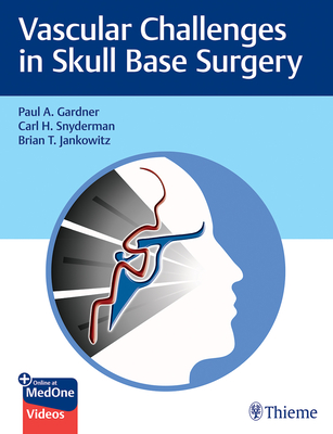 Vascular Challenges in Skull Base Surgery - Gardner, Paul, and Snyderman, Carl, and Jankowitz, Brian