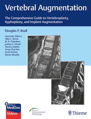 Vertebral Augmentation: The Comprehensive Guide to Vertebroplasty, Kyphoplasty, and Implant Augmentation - Beall, Douglas P