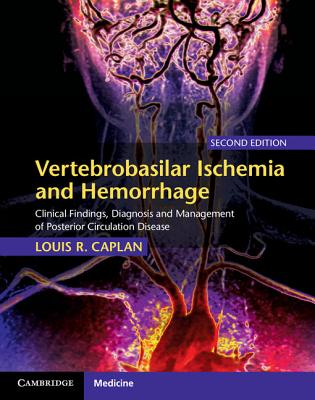 Vertebrobasilar Ischemia and Hemorrhage: Clinical Findings, Diagnosis and Management of Posterior Circulation Disease - Caplan, Louis R, M.D.