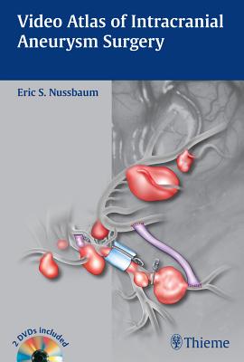 Video Atlas of Intracranial Aneurysm Surgery - Nussbaum, Eric (Editor)
