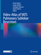 Video-Atlas of VATS Pulmonary Sublobar Resections