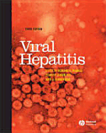 Viral Hepatitis - Thomas, Howard C, BSC, PhD, Frcp (Editor), and Lemon, Stanley (Editor), and Zuckerman, Arie J (Editor)