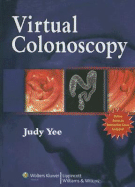 Virtual Colonoscopy - Yee, Judy, MD