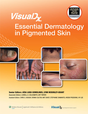 Visualdx: Essential Dermatology in Pigmented Skin - Goldsmith, Lowell A, MD, MPH (Editor), and Papier, Art, MD (Editor)