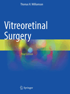 Vitreoretinal Surgery