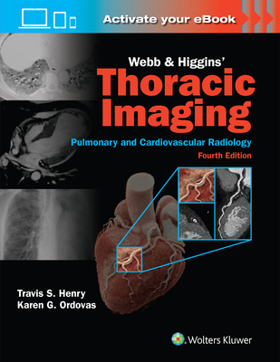 Webb & Higgins Thoracic Imaging: Print + eBook with Multimedia - Henry, Travis, MD, and Ordovas, Karen Gomes, MD, Mas