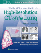 Webb, M?ller and Naidich's High-Resolution CT of the Lung