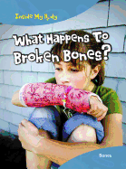 What Happens to Broken Bones?: Bones