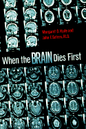 When the Brain Dies First