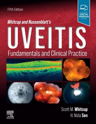 Whitcup and Nussenblatt's Uveitis: Fundamentals and Clinical Practice - Whitcup, Scott M., and Sen, H. Nida