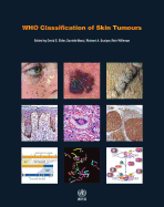 Who Classification of Skin Tumours [Op]