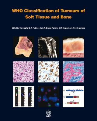 Who Classification of Tumours of Soft Tissue and Bone [op] - Who Classification of Tumours Editorial Board