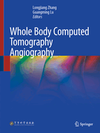 Whole Body Computed Tomography Angiography