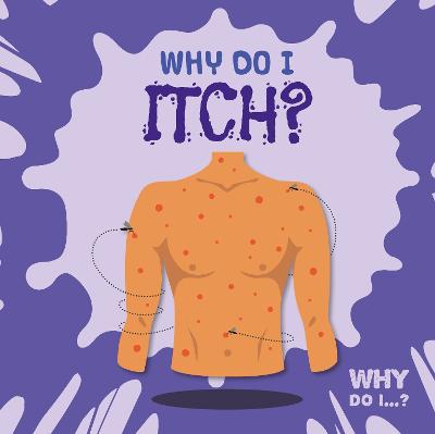 Why Do I Itch? - Holmes, Kirsty