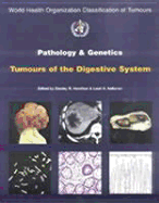 World Health Organization Classification of Tumours: Pathology and Genetics of Tumours of the Digestive System