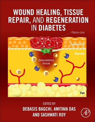 Wound Healing, Tissue Repair, and Regeneration in Diabetes - Bagchi, Debasis (Editor), and Das, Amitava (Editor), and Roy, Sashwati (Editor)