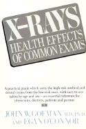X-Rays: Health Effects of Common Exams