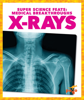 X-Rays - Klepeis, Alicia Z