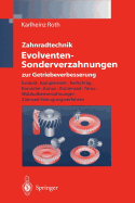 Zahnradtechnik Evolventen-Sonderverzahnungen Zur Getriebeverbesserung: Evoloid-, Komplement-, Keilschrag-, Konische-, Konus-, Kronenrad-, Torus-, Walzkolbenverzahnungen, Zahnrad-Erzeugungsverfahren